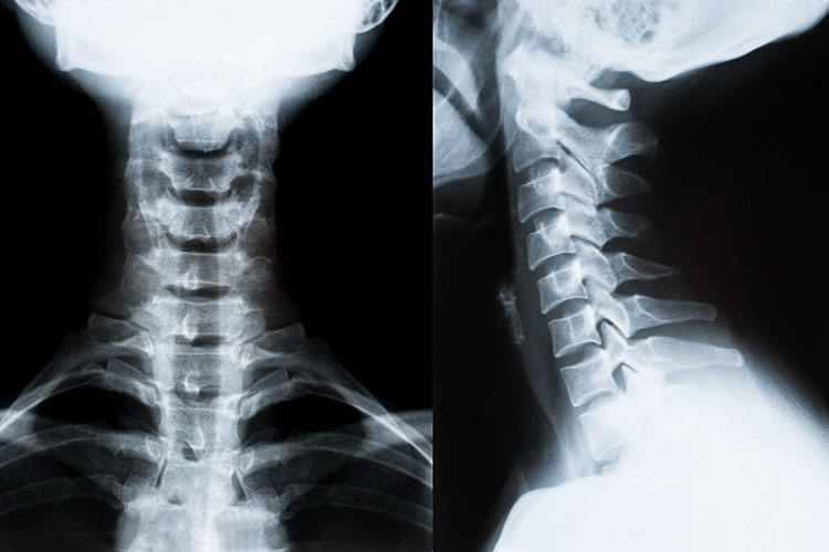 neck xray