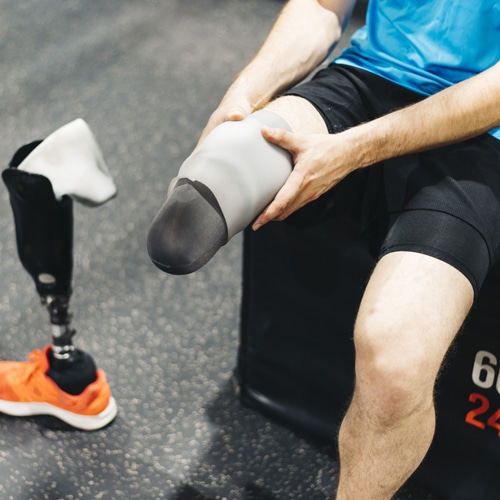 Amputation injury - loss of limb - loss of leg - Amputation Injuries